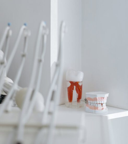 dental model on white table
